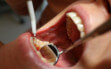 dentalcare-10_leczenie2